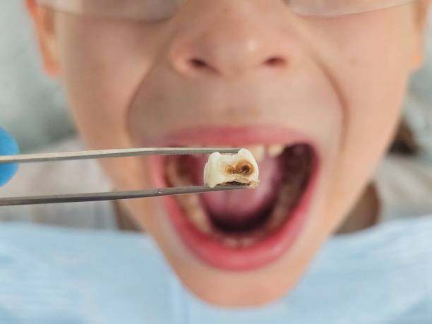 Best Mobile Emergency Dentist in Tara Hills, CA